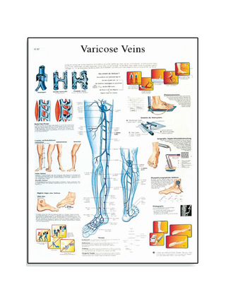 Veenilaiendite lamineeritud plakat