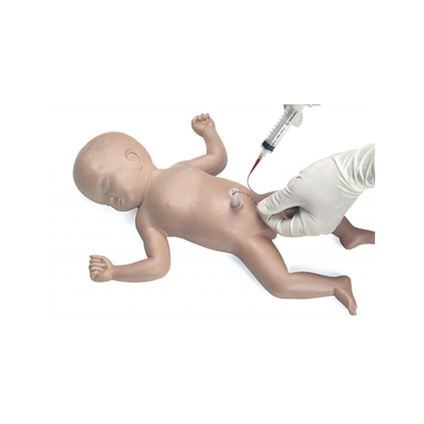 Baby Umbi nabanööri kateetri sisestamine