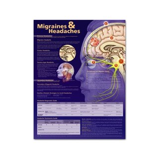Õppeplakat Migreen ja peavalu, lamineeritud 51x66 cm (ingliskeelne)