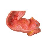 Jämesoole detailne mudel, mis näitab mitmeid haigusi