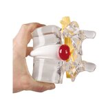 Herniated diski simulaator