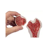 Osteoporoos Reieluu