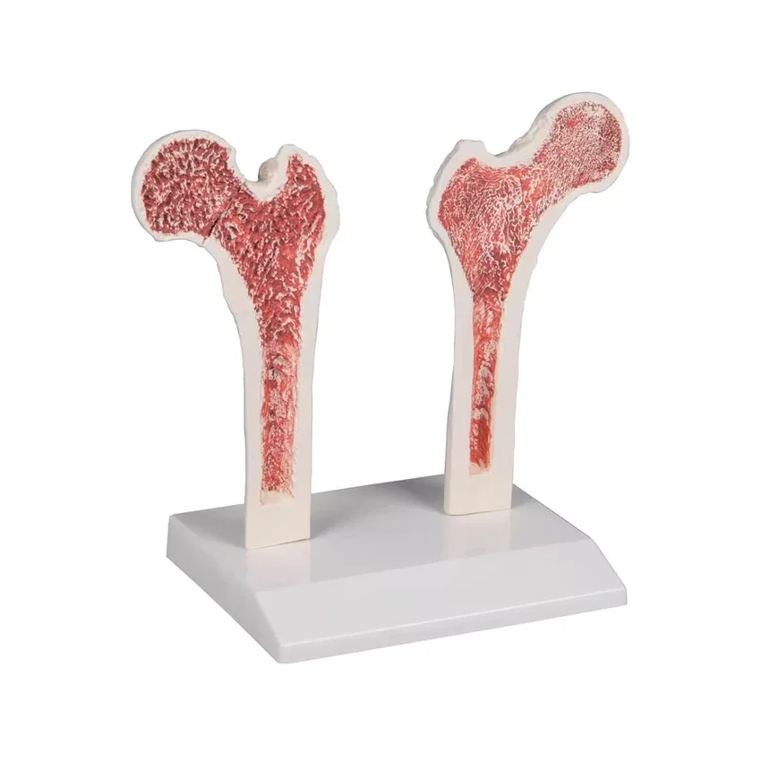 Osteoporoos Reieluu